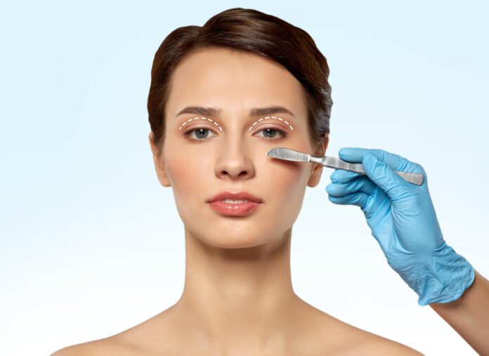 Eyelid Surgery