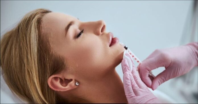 Lip Fillers